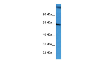 BCAM Rabbit Polyclonal Antibody
