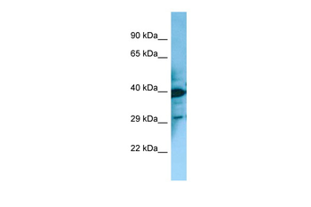 MCHR2 Rabbit Polyclonal Antibody