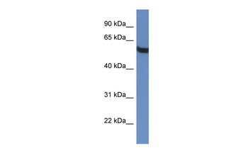 TBC1D10A Rabbit Polyclonal Antibody