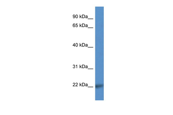 CD99L2 Rabbit Polyclonal Antibody