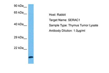 SERAC1 Rabbit Polyclonal Antibody