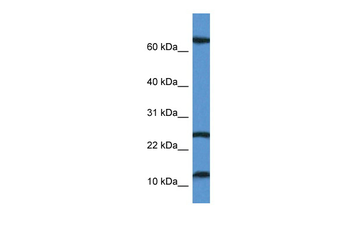 TARP Rabbit Polyclonal Antibody