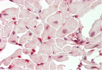 PCSK9 Rabbit Polyclonal Antibody