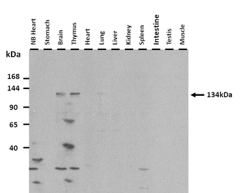 INPP5D Rabbit Polyclonal Antibody