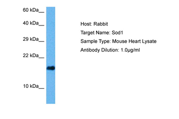 SOD1 Rabbit Polyclonal Antibody
