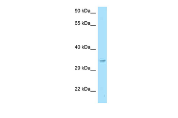 RACK1 Rabbit Polyclonal Antibody