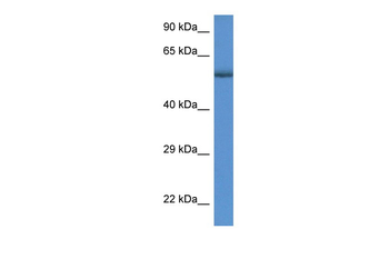 GBA Rabbit Polyclonal Antibody