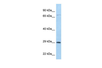 F11R Rabbit Polyclonal Antibody