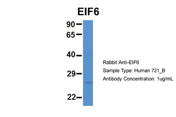 EIF6 Rabbit Polyclonal Antibody