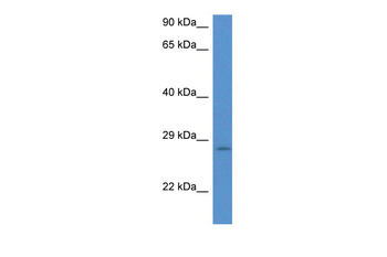 EIF6 Rabbit Polyclonal Antibody