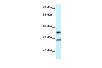 RPS6 Rabbit Polyclonal Antibody