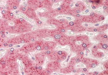 RICTOR Rabbit Polyclonal Antibody