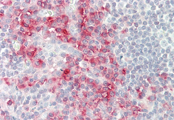 RICTOR Rabbit Polyclonal Antibody