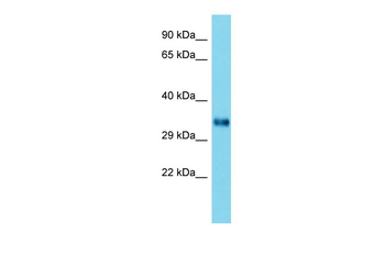 Homer2 Rabbit Polyclonal Antibody