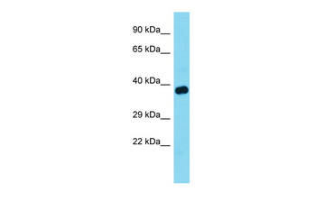 TOM1L1 Rabbit Polyclonal Antibody
