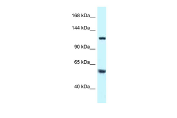 TBCD Rabbit Polyclonal Antibody