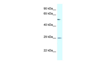 AMY2B Rabbit Polyclonal Antibody