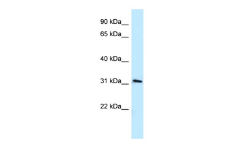 MRPL19 Rabbit Polyclonal Antibody