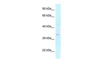 GOLPH3 Rabbit Polyclonal Antibody
