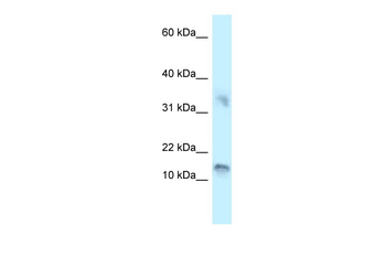 UTS2D Rabbit Polyclonal Antibody