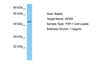 GPER Rabbit Polyclonal Antibody