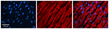 BABAM2 Rabbit Polyclonal Antibody