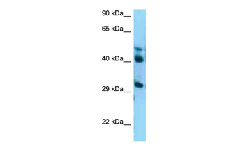 BABAM2 Rabbit Polyclonal Antibody