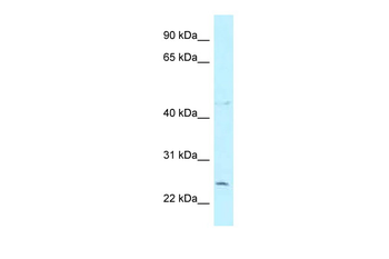 CCDC85B Rabbit Polyclonal Antibody
