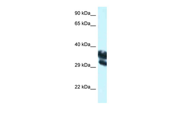 EEF1D Rabbit Polyclonal Antibody