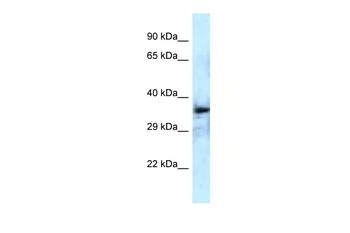 DEPTOR Rabbit Polyclonal Antibody