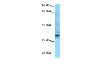 PPP6C Rabbit Polyclonal Antibody