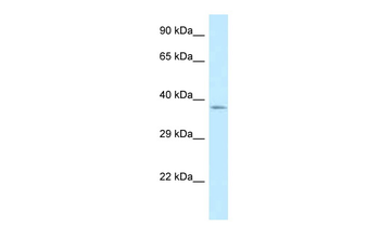 LDAH Rabbit Polyclonal Antibody