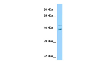 UBE2Q1 Rabbit Polyclonal Antibody