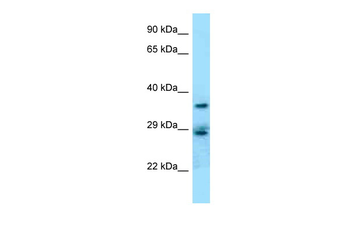 CD68 Rabbit Polyclonal Antibody