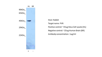 PVR Rabbit Polyclonal Antibody