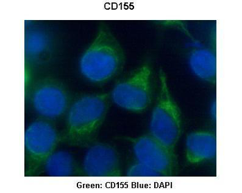 PVR Rabbit Polyclonal Antibody