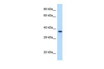 CD1A Rabbit Polyclonal Antibody
