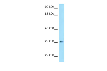 CD79A Rabbit Polyclonal Antibody