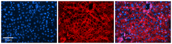 CD81 Rabbit Polyclonal Antibody