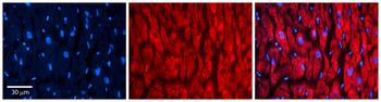 HLA-DPB1 Rabbit Polyclonal Antibody
