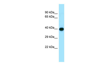 ADIPOR1 Rabbit Polyclonal Antibody