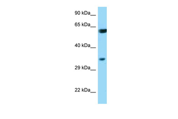 BAG1 Rabbit Polyclonal Antibody