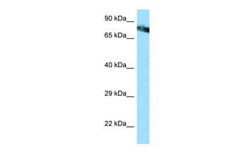 MCAM Rabbit Polyclonal Antibody