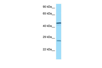 TREM1 Rabbit Polyclonal Antibody