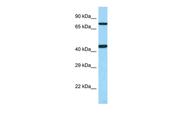 UTS2R Rabbit Polyclonal Antibody