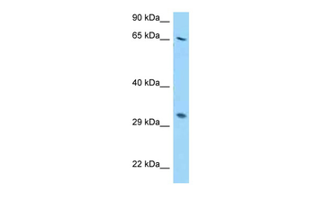 RPS2 Rabbit Polyclonal Antibody