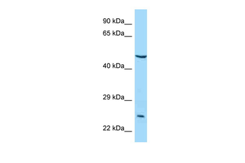 IL5RA Rabbit Polyclonal Antibody