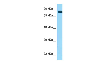 ITGB3 Rabbit Polyclonal Antibody