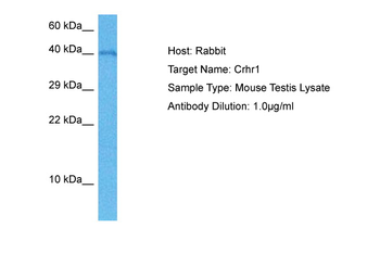CRHR1 Rabbit Polyclonal Antibody