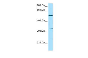 NCR1 Rabbit Polyclonal Antibody